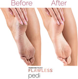 Finishing Touch Flawless Pedi Electronic